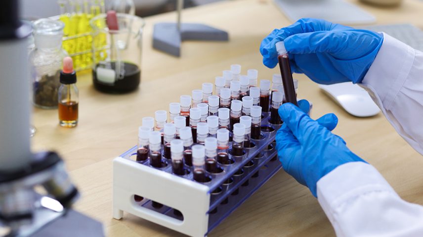 Fotografia de ampolas de sangue.