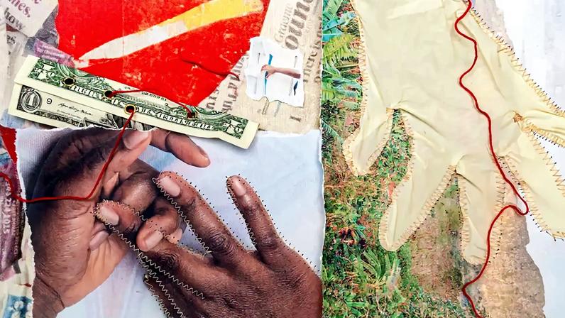 A photo illustration depicting images representing the cost of maternal mortality, showing a collection of items: a photo of hands, a few U.S. dollars, a hospital glove, newspaper clippings, and a landscape photo. The various items are stitched in place with red thread.