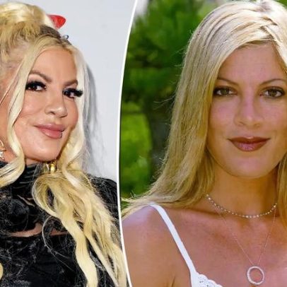 Tori Spelling esclarece uso de fillers após críticas à aparência