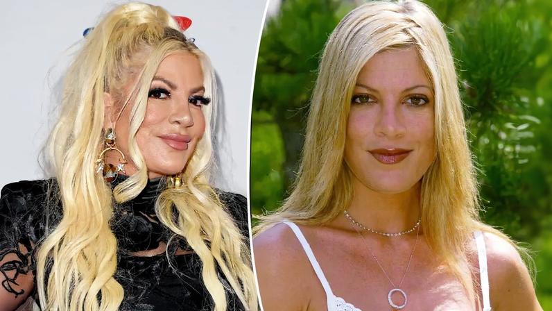 Tori Spelling (seen above at the 2024 iHeartRadio 102.7 KIIS FM’s Jingle Ball 2024) addressed her fillers after fans made negative comments about her appearance.