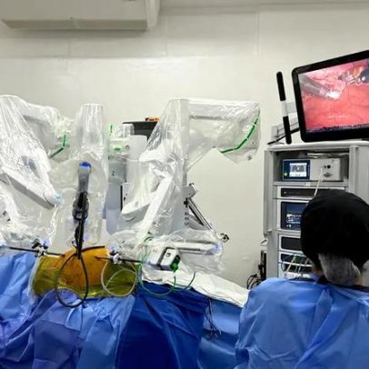 Paciente com coração no lado direito realiza cirurgia cardíaca robótica