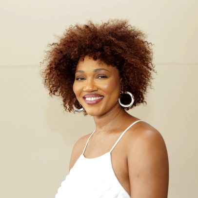 Cantora Luedji Luna retira tumor de quase 20 cm da perna