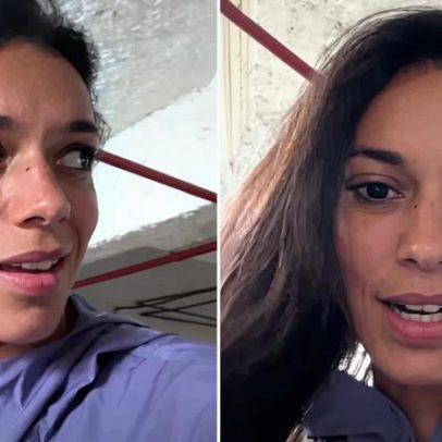 Ex-BBB Alane Dias afirma ter sido atropelada por moto no Rio