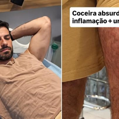 Lucas Malvacini é internado na Indonésia após reação a ácaros