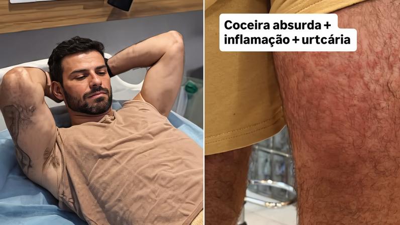 Lucas Malvacini é hospitalizado na Indonésia após reação a ácaros - Reprodução