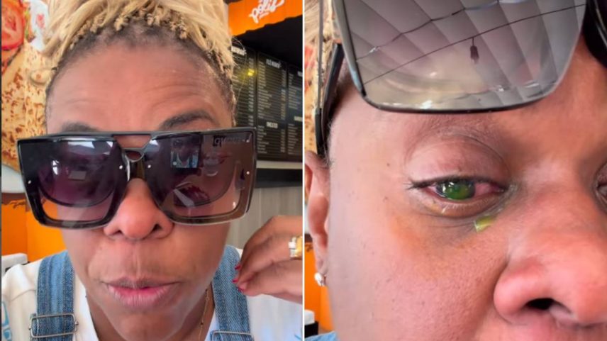 Cacau Protásio tem perda de visão após usar pomada