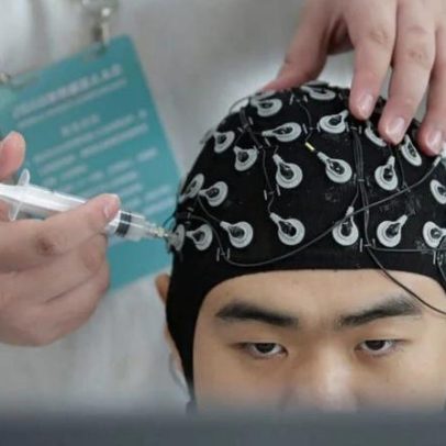 China aprova pela primeira vez dispositivo médico cérebro-computador