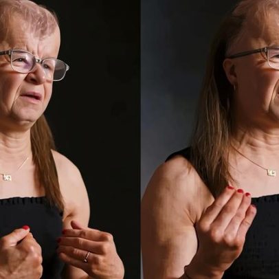 Mulher com síndrome de morte precoce relata viver cada dia como uma bênção
