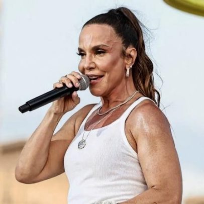 Ivete Sangalo tira glúten e lactose para inflamação; especialista USP comenta