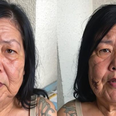 Juju do Pix faz nova cirurgia para remover óleo do rosto, opiniões dividem