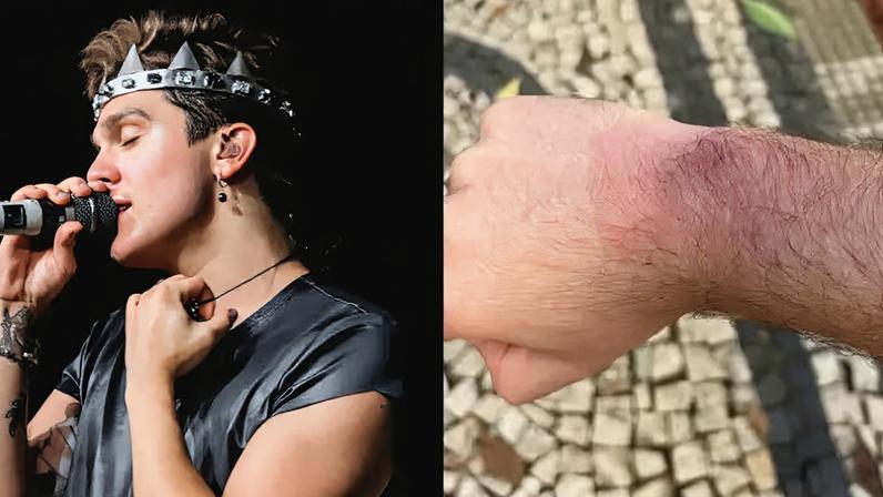 Fãs relatam queimaduras após uso de pulseiras de LED em show de Luan Santana