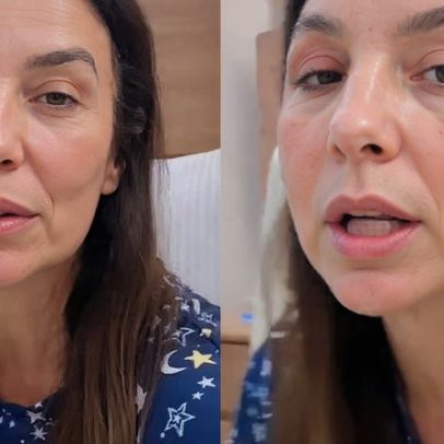 Ivete Sangalo sofre fraturas no rosto após desmaio e é submetida a cirurgia