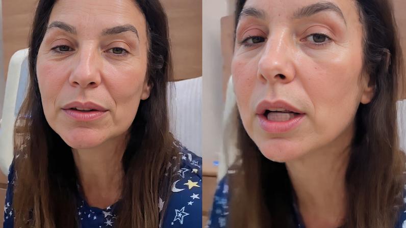 O que aconteceu com Ivete Sangalo? Cantora quebra dois ossos do rosto após desmaio, passa por cirurgia e surge inchada nas redes: ‘Estou bem’