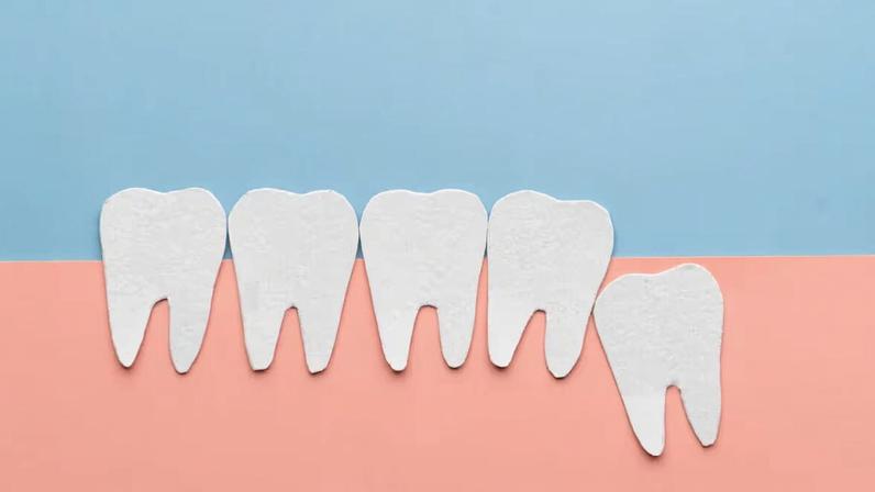 Dente do siso: por que algumas pessoas não têm?