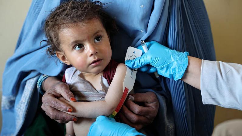 ONU alerta que 200 mil crianças afegãs enfrentarão desnutrição aguda em 2026