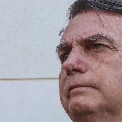 Bolsonaro tem alta prevista para sexta, segundo boletim médico
