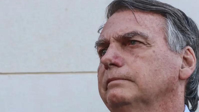 Bolsonaro está sem sinais de infecção aguda, segundo boletim divulgado nesta quinta