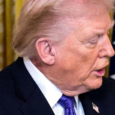 Casa Branca diz que Trump usa tratamento preventivo para erupção no pescoço