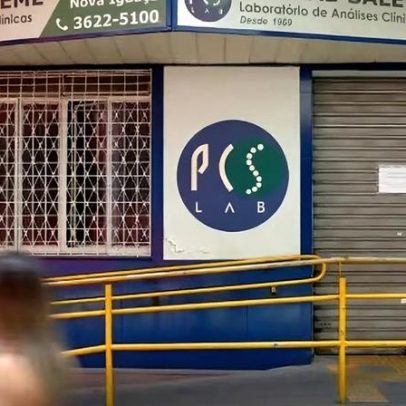Morre paciente com HIV após transplante no Rio de Janeiro