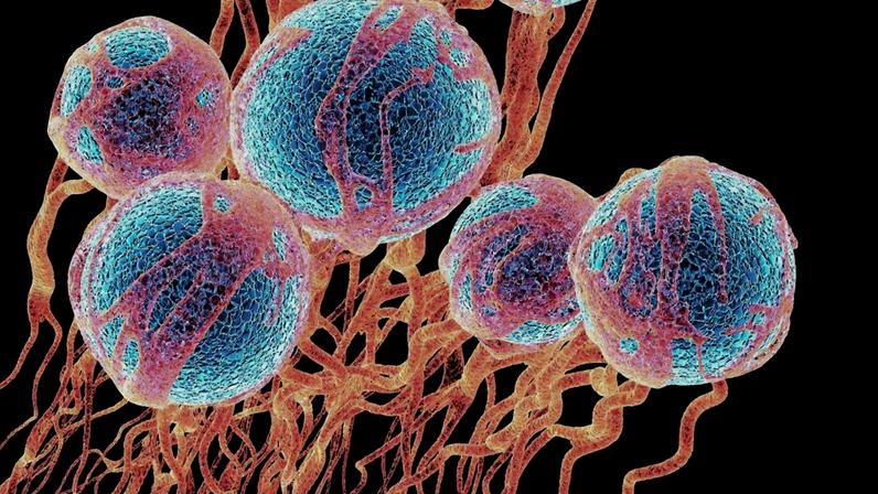 Células cancerígenas (azul) e novos vasos sanguíneos. (Foto: Science Photo Library via Canva)