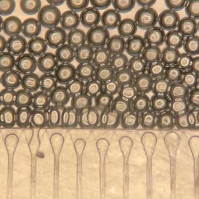 Fígado satélite injetável pode oferecer alternativa ao transplante