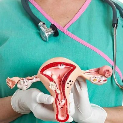 Brasil lidera consenso sobre tratamento do câncer de ovário em países em desenvolvimento