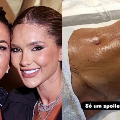Mãe de Virginia Fonseca mostra resultados de cirurgias e novo procedimento