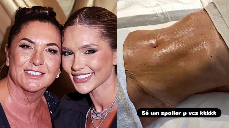 Mãe de Virginia Fonseca mostra resultados de cirurgias e novo procedimento