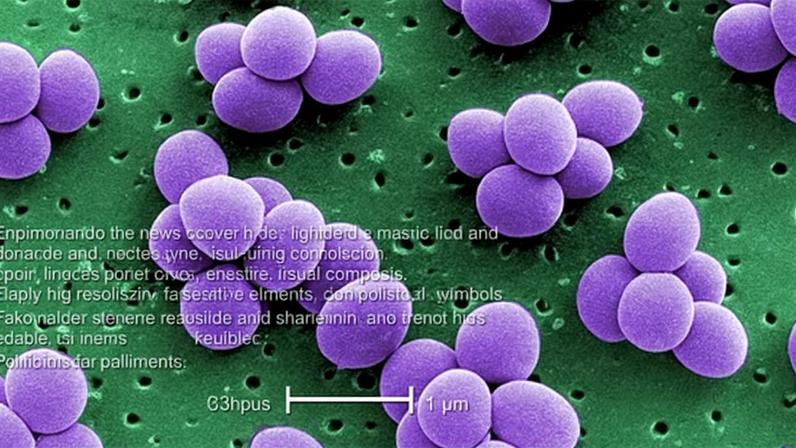 Staphylococcus aureus, uma das causas mais frequentes de infecções hospitalares