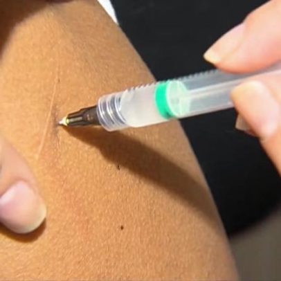 Sarampo é risco grave, diz infectologista e enfatiza duas doses da vacina