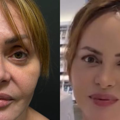 Gabriela Spanic aparece com rosto mais jovem após procedimentos