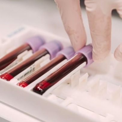 Oncologia personalizada: o futuro do tratamento do câncer com Kalil