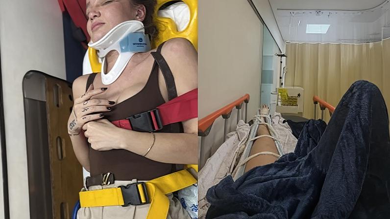 Anna Livya Padilha sofreu um acidente de moto
