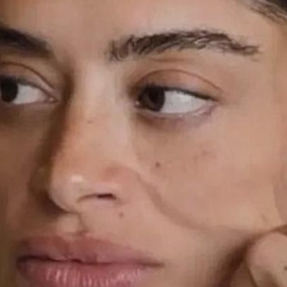 Lifting facial de Aline Campos aos 38 reacende debate sobre idade ideal