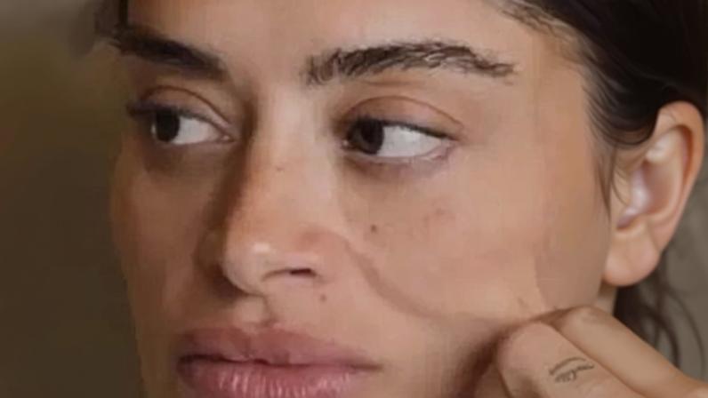 Aline Campos antes e depois de realizar o lifting facial — Foto: Reprodução/Instagram