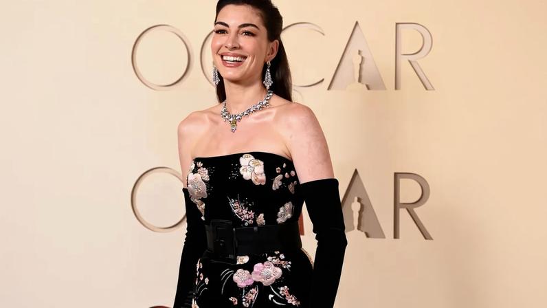 Anne Hathaway revela truque de lifting instantâneo usado no Oscar 2026