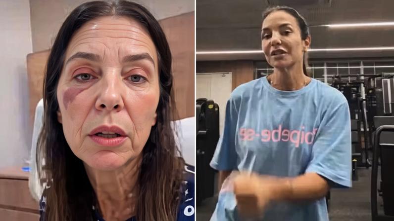 Ivete Sangalo retoma treinos após cirurgia no rosto