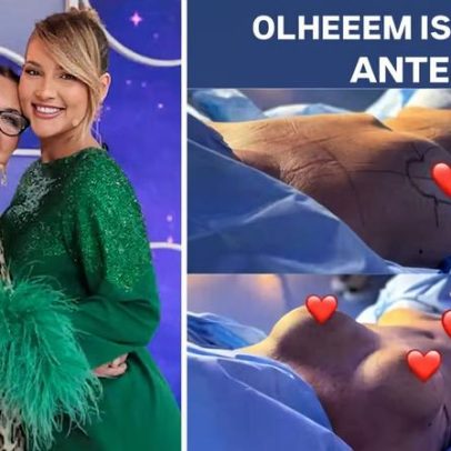 Virginia Fonseca revela resultado de cirurgia plástica da mãe