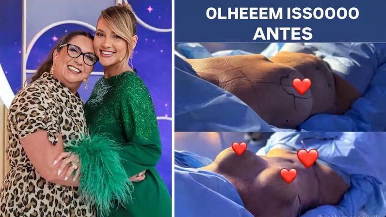 Virginia Fonseca mostrou antes e depois da mãe, Margareth Serrão — Foto: Reprodução/Instagram