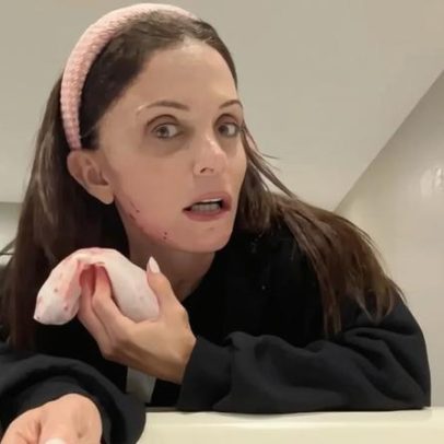 Bethenny Frankel corta o rosto com ferramenta de beleza comprada pelas redes