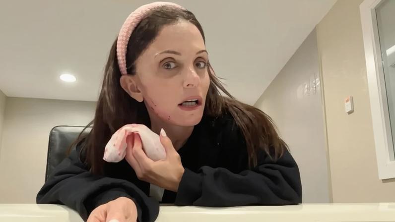 Bethenny Frankel corta o rosto com ferramenta de beleza comprada pelas redes