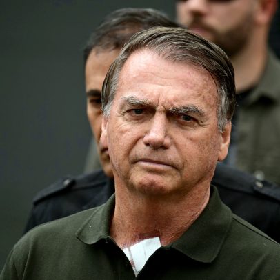 Bolsonaro permanece estável e consciente, sem precisar de entubação, diz médico