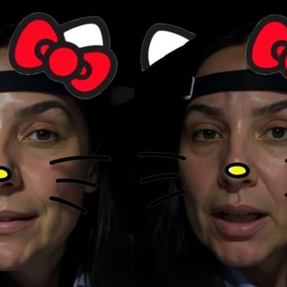 Ivete Sangalo atualiza sobre saúde e relata inchaço