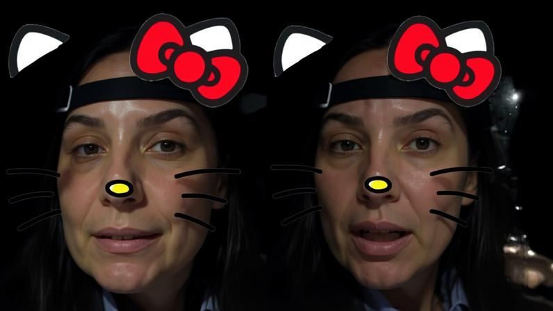 Ivete Sangalo atualiza sobre saúde e relata inchaço