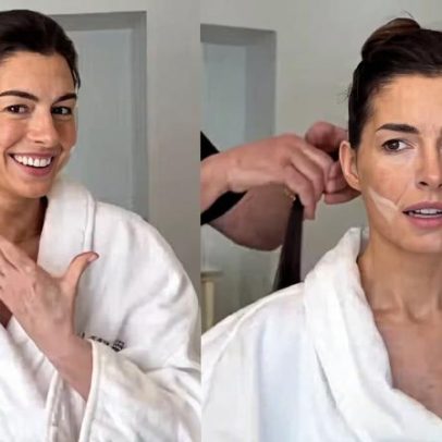 Anne Hathaway revela truque de beleza para Oscar que parece facelift