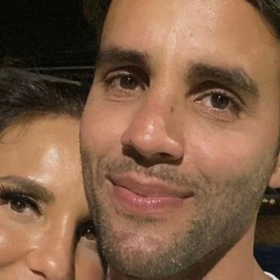 Ivete Sangalo recebe apoio do ex-marido após acidente e cirurgia