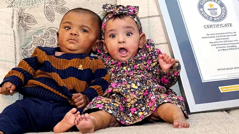 Adiah Laelynn e Adrial Luka Nadarajah, os gêmeos mais prematuros do mundo — Foto: Reprodução/Site Guinness World Records