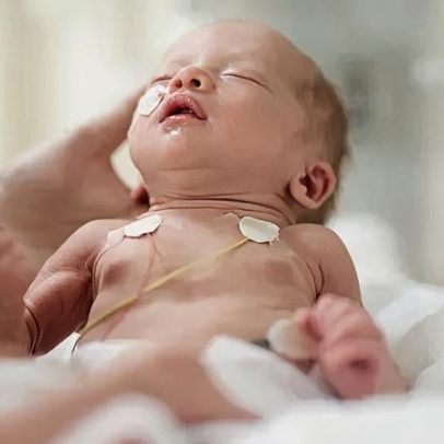Anvisa aprova medicamento para prevenir VSR em bronquiolite
