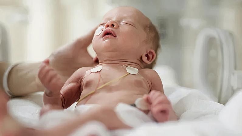 VSR é uma das principais causas de hospitalizações dos bebês — Foto: Getty Images