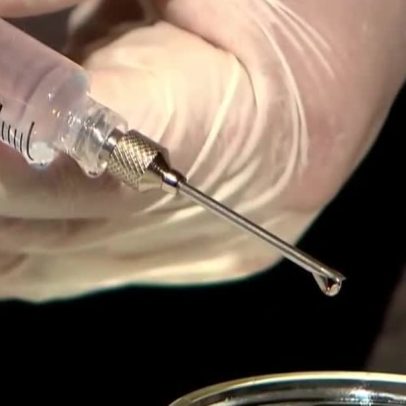 Cirurgião plástico é preso suspeito de usar silicone industrial em pacientes
